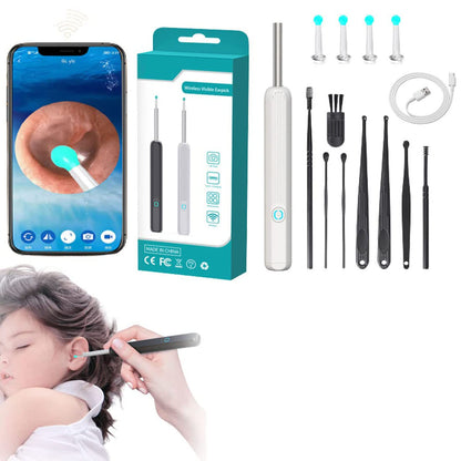 Smart Visual Ear Cleaner with HD Camera – Wireless Ear Wax Removal Otoscope with 6 LED Lights, USB-C Charging, iPhone & Android Compatible