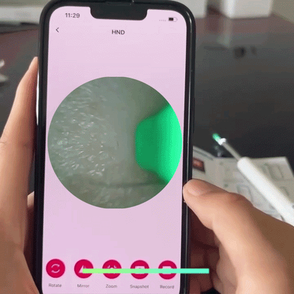 Smart Visual Ear Cleaner with HD Camera – Wireless Ear Wax Removal Otoscope with 6 LED Lights, USB-C Charging, iPhone & Android Compatible