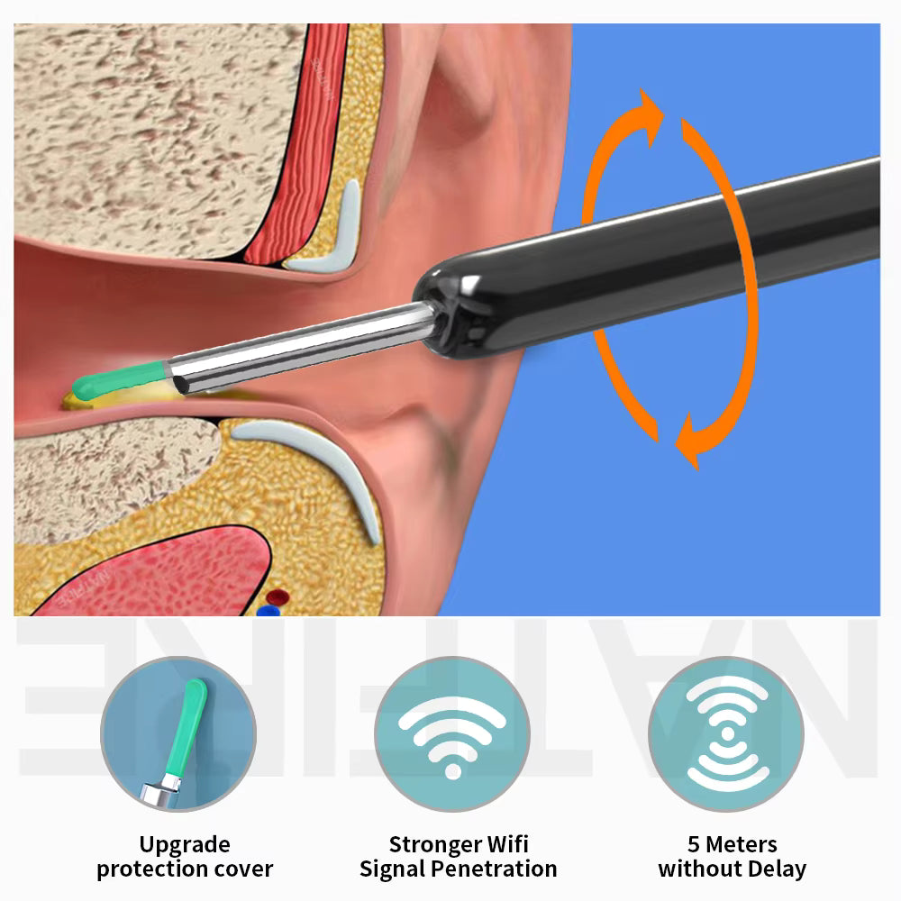 Smart Visual Ear Cleaner with HD Camera – Wireless Ear Wax Removal Otoscope with 6 LED Lights, USB-C Charging, iPhone & Android Compatible