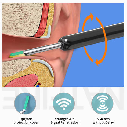 Smart Visual Ear Cleaner with HD Camera – Wireless Ear Wax Removal Otoscope with 6 LED Lights, USB-C Charging, iPhone & Android Compatible